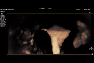 Ανακαλύψτε το μέλλον της διάγνωσης γονιμότητας σε ένα μόνο ραντεβού!