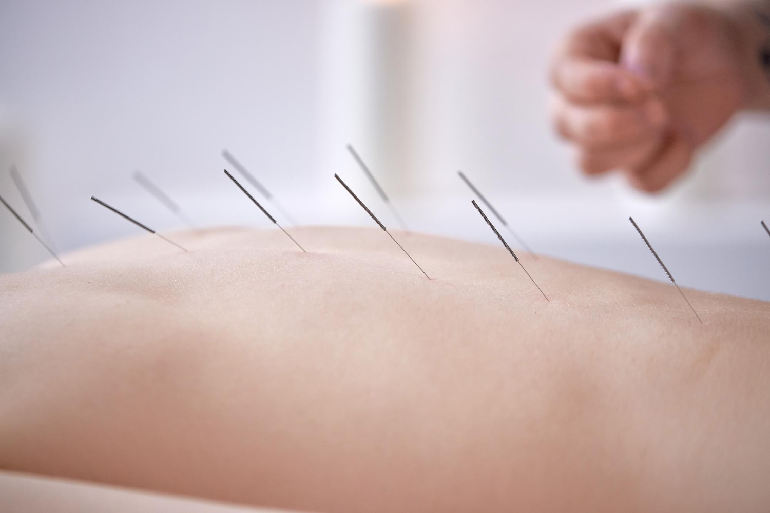 ΒΕΛΟΝΙΣΜΟΣ  
