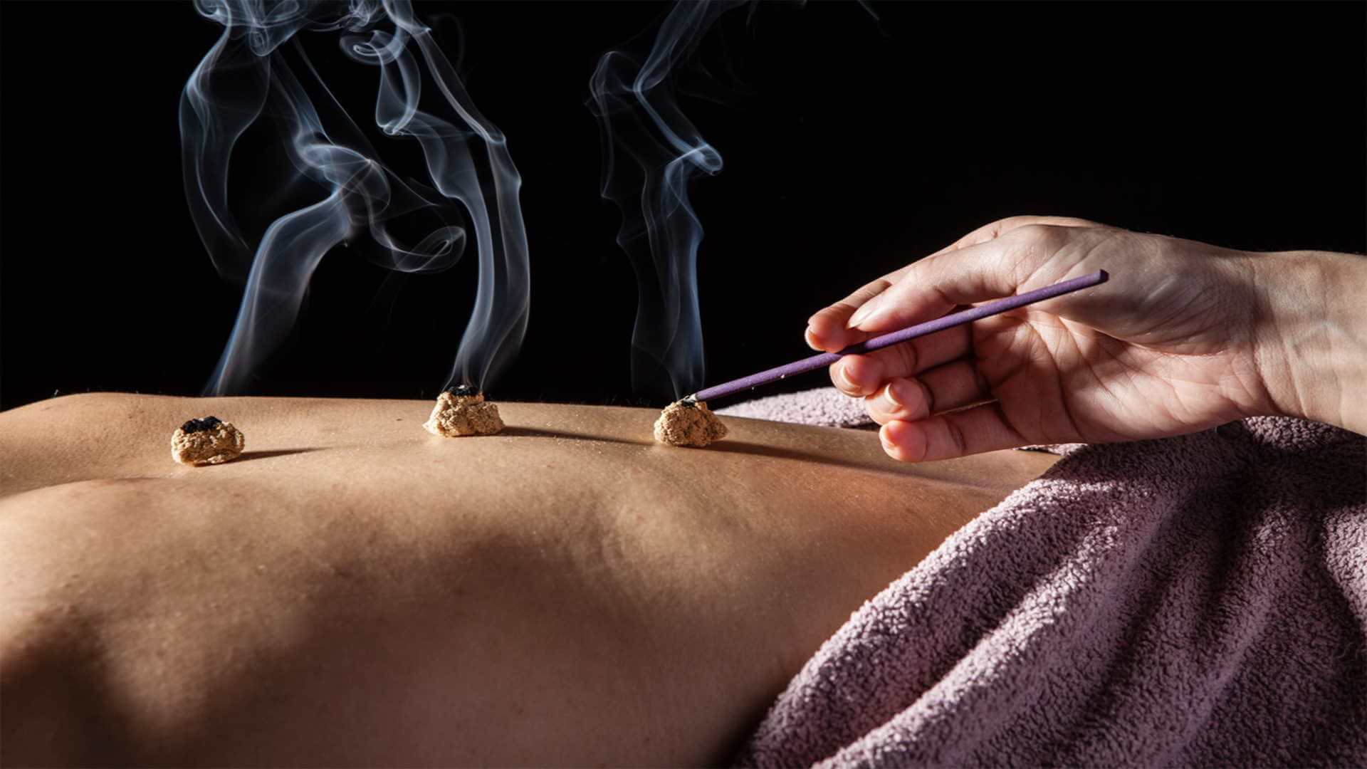 Ηλεκτροβελονισμός 
