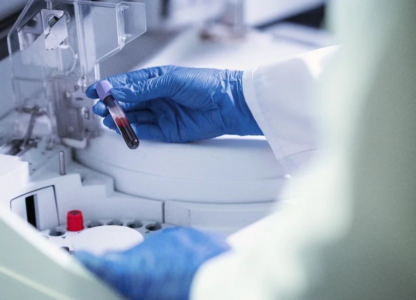 Ορμονολογικός έλεγχος 