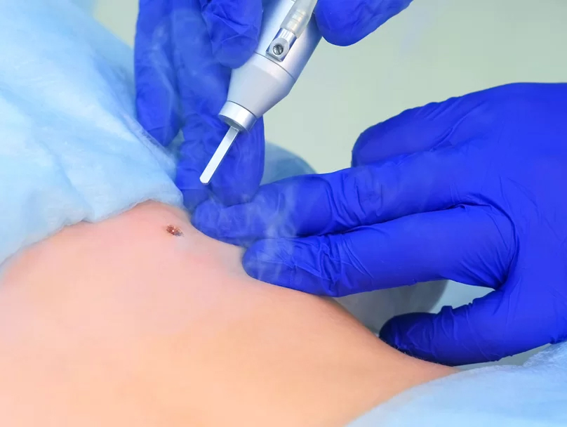 Δερματοχειρουργική 