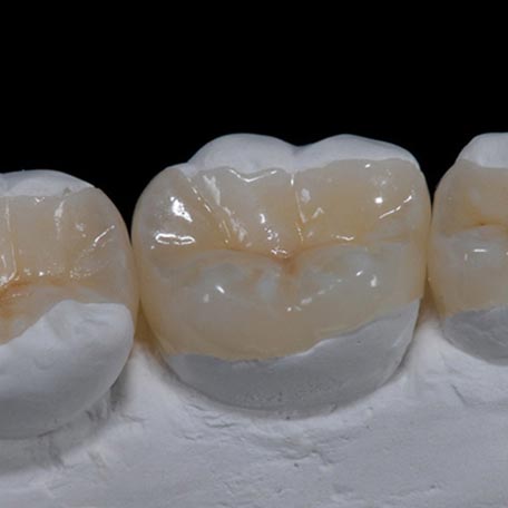 ΟΔΟΝΤΙΚΗ ΧΕΙΡΟΥΡΓΙΚΗ (ΣΦΡΑΓΙΣΜΑΤΑ) 