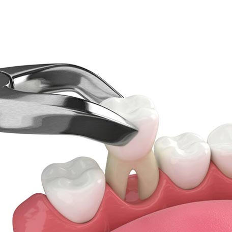 ΧΕΙΡΟΥΡΓΙΚΗ 