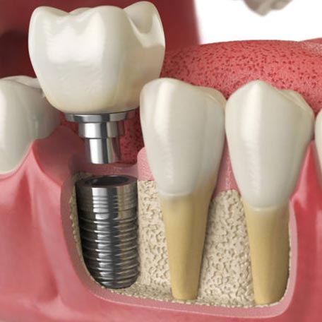 ΕΜΦΥΤΕΥΜΑΤΑ 