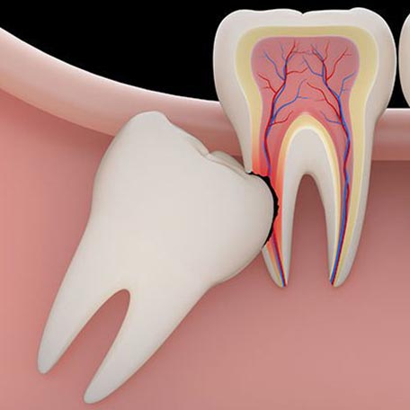ΕΞΑΓΩΓΗ ΦΡΟΝΙΜΗΤΗ 
