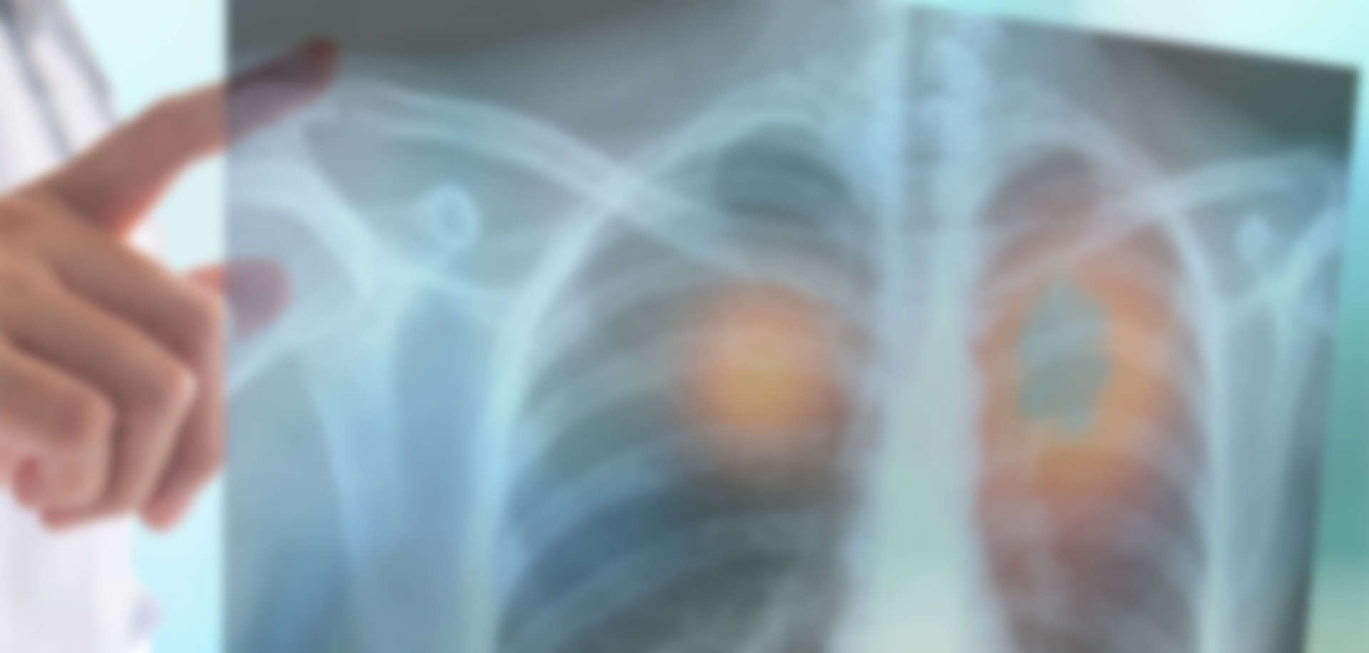 Ακτινογραφίες για όλα τα μέρη του σώματος 