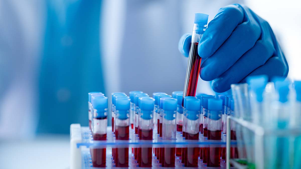 Μικροβιολογικό εργαστήριο Μικροβιολογικό εργαστήριο