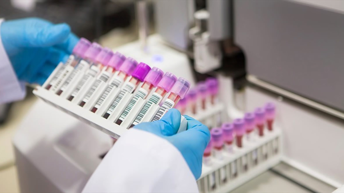 Μικροβιολογικό εργαστήριο Μικροβιολογικό εργαστήριο