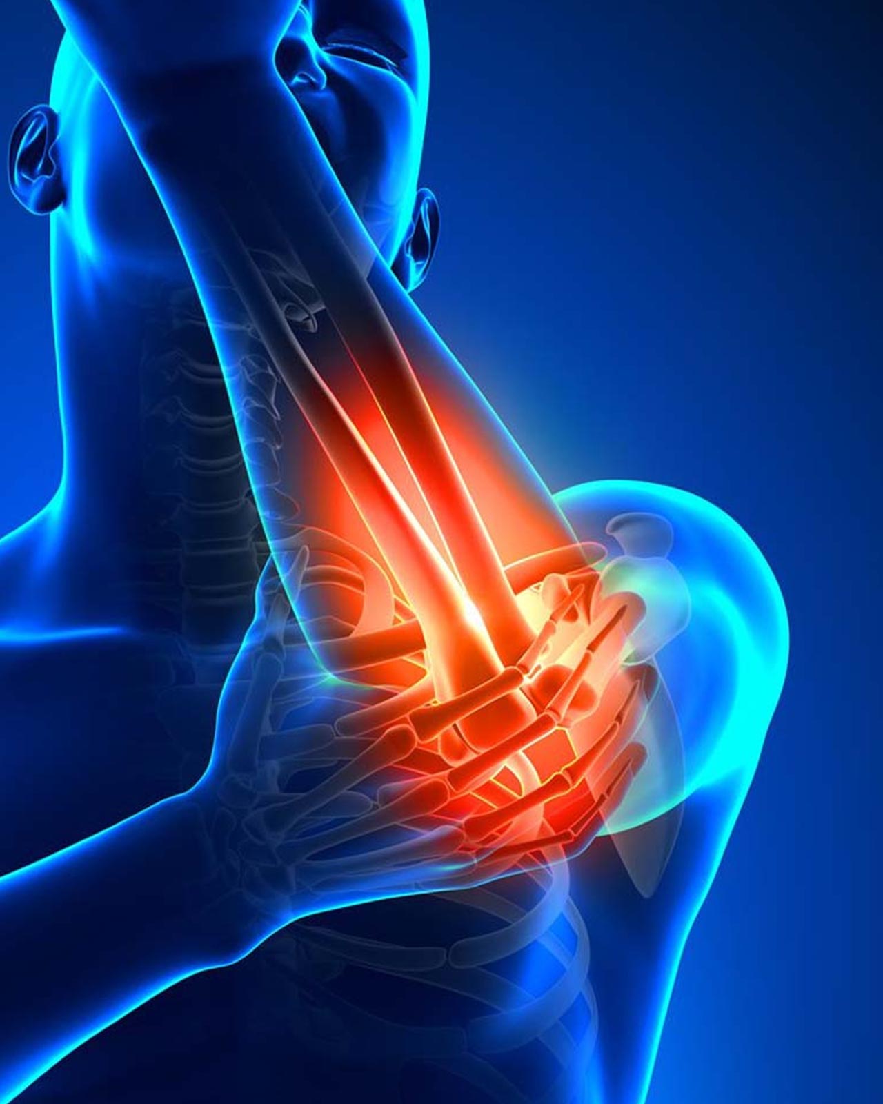 Τσιρόζογλου